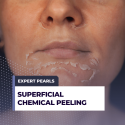 Superficial and light peels impact the: